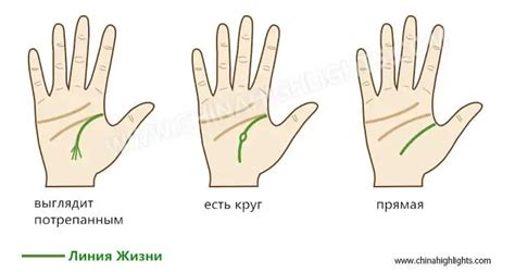 Висюльки на руках: их значения и борьба