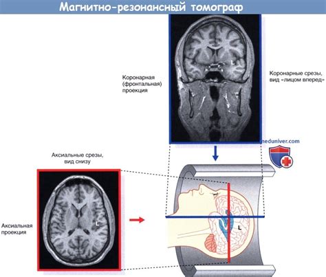 Влияние аваскулярного кровотока на организм