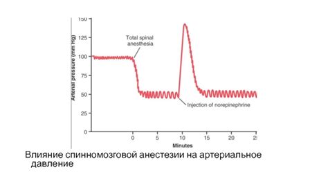 Влияние анестезии на артериальное давление