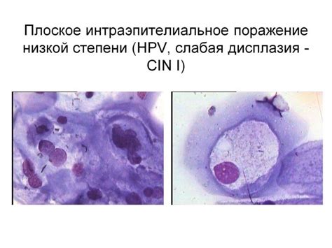 Влияние внешних факторов на изменение клеток плоского эпителия