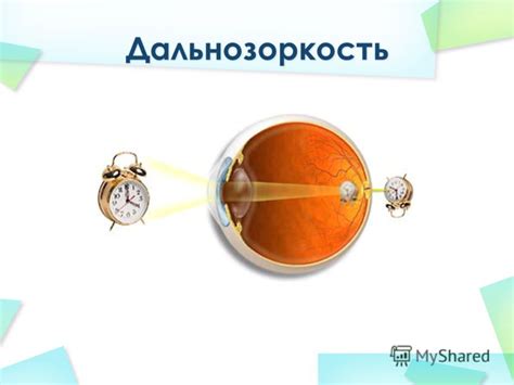 Влияние возрастных изменений на работу оптической системы глаза