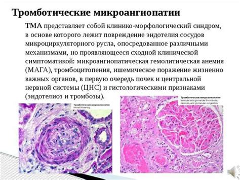 Влияние вторичной кардиомиопатии на функционирование организма