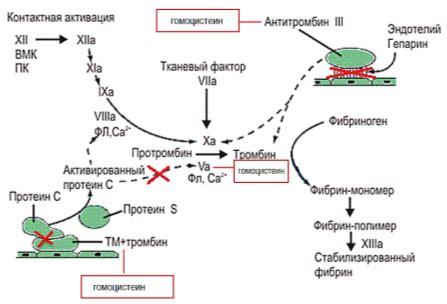 Влияние гомоцистеина на здоровье мозга