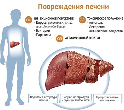 Влияние заболеваний печени на уровень триглицеридов