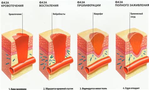 Влияние интенсивного кислорода на заживление ран и ран после хирургических операций