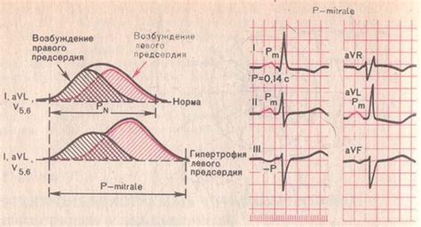 Влияние нагрузки левого предсердия на работу других органов и систем организма