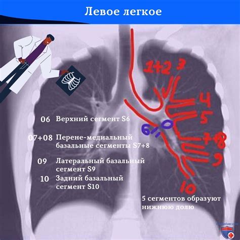 Влияние общего балла поражения легких 8 на диагноз