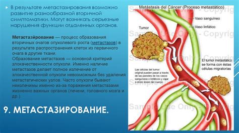 Влияние опухоли her2 позитивной на организм