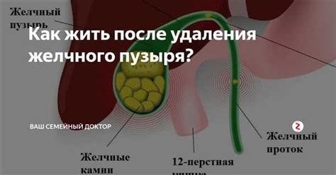 Влияние отключенного желчного пузыря на организм