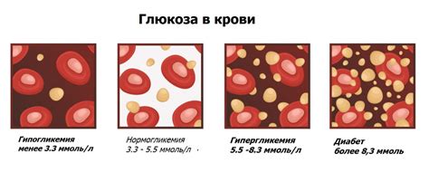 Влияние питания на уровень глюкозы в моче