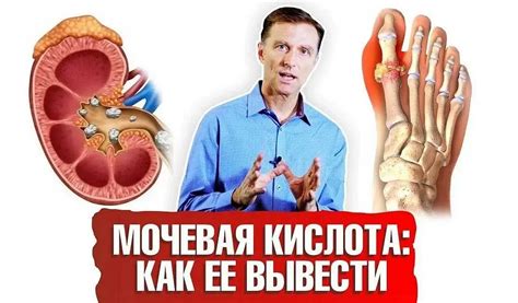 Влияние питания на уровень мочевой кислоты