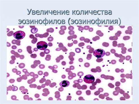 Влияние повышенного количества эозинофилов на организм