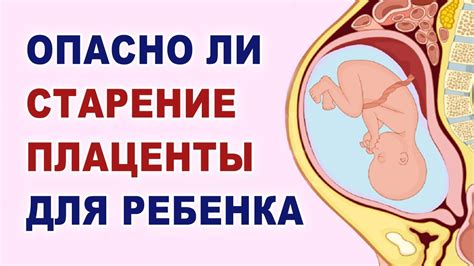 Влияние преждевременного созревания плаценты на ребенка