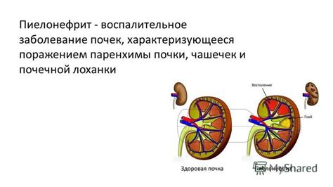 Влияние расширения чашечек почек на организм