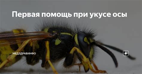 Влияние рода на разбор снов о укусе осы в ногу: индивидуальные особенности и социокультурный контекст