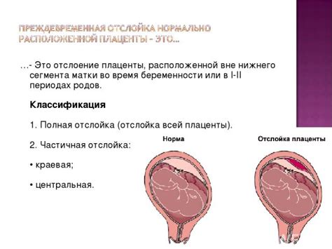 Влияние рода родов на размещение плаценты