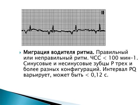 Влияние синусового водителя ритма на развитие ребенка