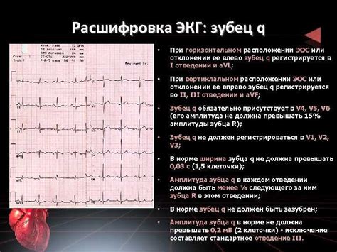 Влияние смещения ST вверх в V4 на лечение