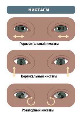 Влияние спонтанного нистагма на зрительные функции и органы равновесия