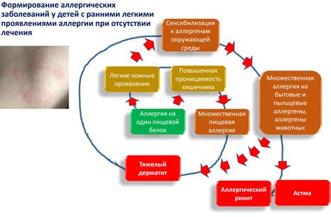 Влияние стресса и аллергии на местные признаки вакцинации