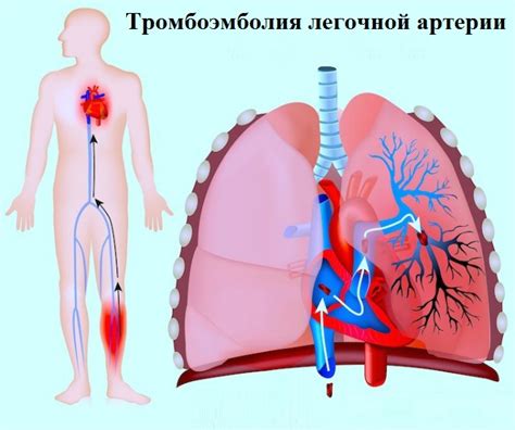 Влияние увеличенного притока крови в правую маточную артерию на организм