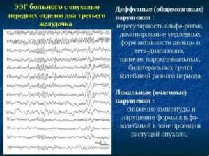 Влияние умеренных диффузных изменений корковой ритмики головного мозга на здоровье