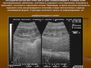 Влияние штриховидных гиперэхогенных включений на организм