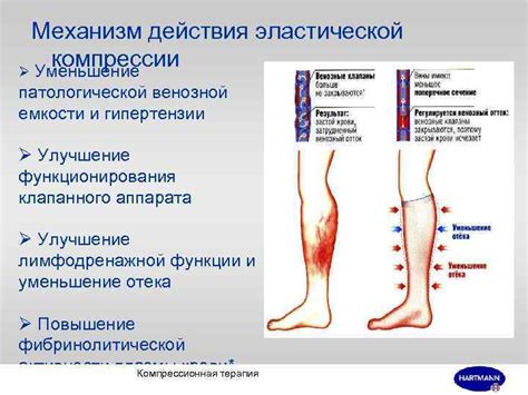 Влияние эластической компрессии на нижние конечности