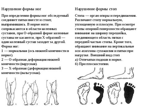 Влияние эмоционального состояния на потоотделение в области подошв ног