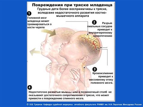 Внезапное появление тряски и частое движение головы