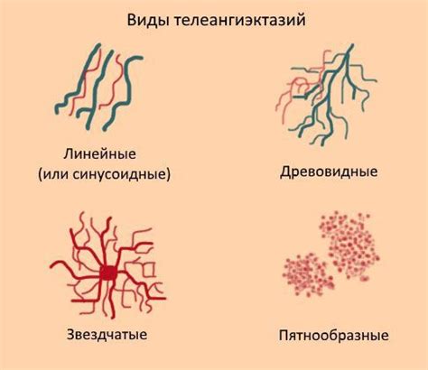 Внешний вид сосудистых звездочек