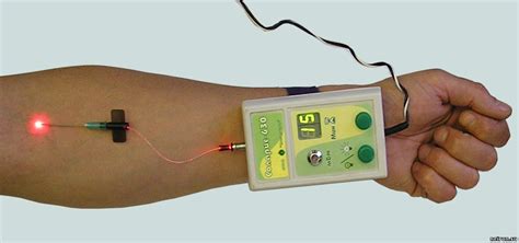 Внутрисосудистое лазерное облучение крови ВЛОК: принцип работы и эффективность
