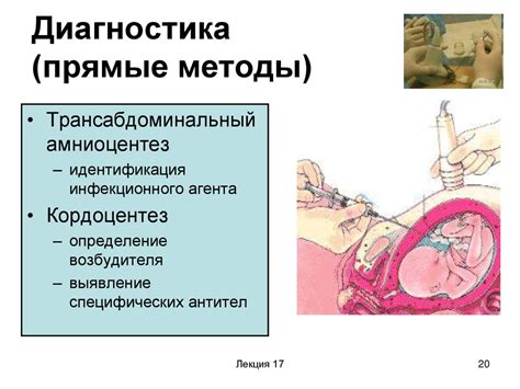 Внутриутробные влияния