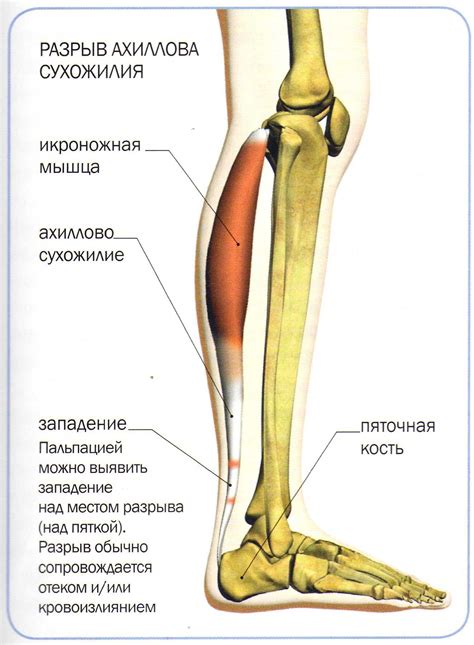 Воздействие на мышцы и сухожилия