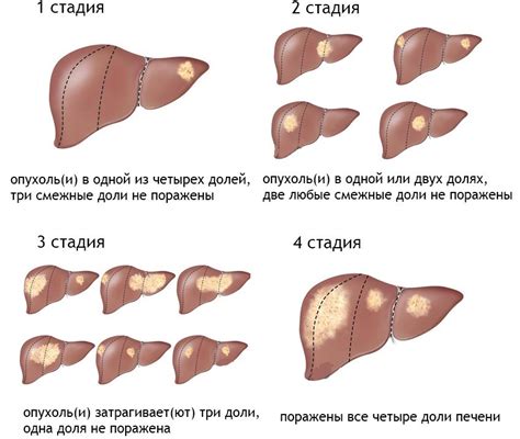 Воздействие на печень и другие органы