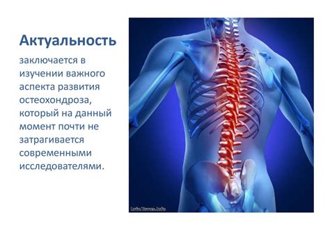 Возможное лечение и профилактика снижения высоты межпозвоночных дисков