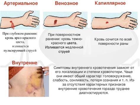 Возможное разъяснение отсутствия кровотечения