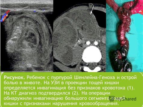 Возможности изучения кровотока с помощью УЗИ