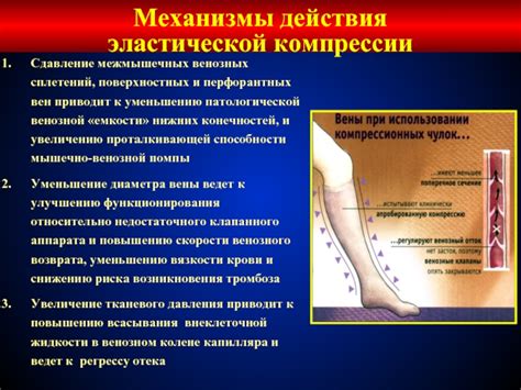 Возможности эластической компрессии для нижних конечностей