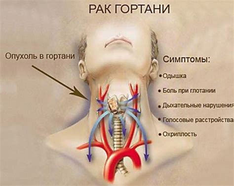 Возможные заболевания, вызывающие необычное ощущение в области горла