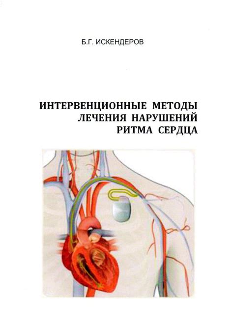 Возможные методы лечения и профилактика нарушений ритма