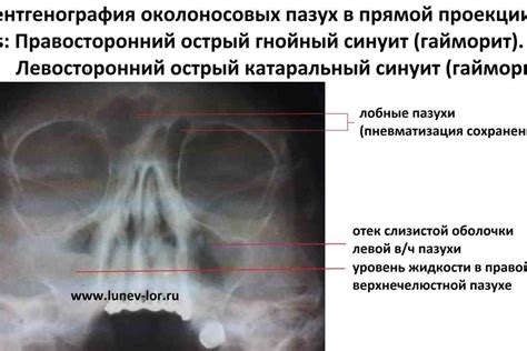 Возможные патологии и заболевания