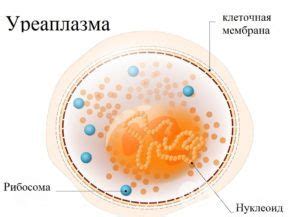 Возможные последствия необнаружения уреаплазмы парвум