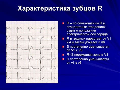 Возможные последствия отсутствия зубца р на ЭКГ