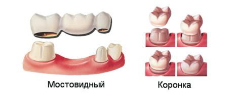 Возможные последствия отсутствия соска