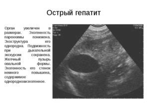 Возможные последствия сопоставимой эхогенности для здоровья