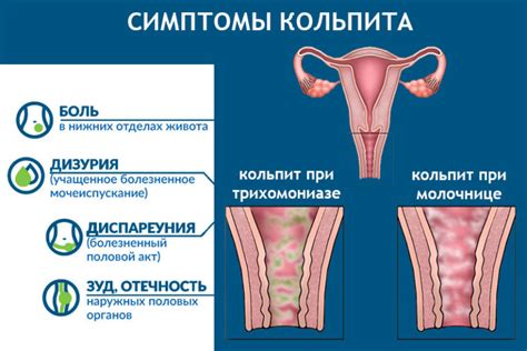 Возможные причины малавах у девушек