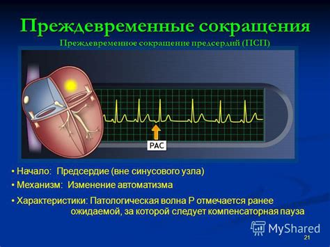 Возможные причины низкого сердечного ритма