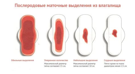 Возможные причины обильных месячных и способы контроля над кровотечением