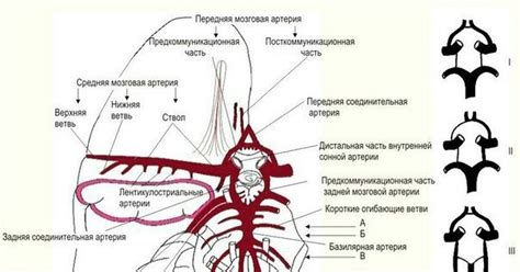 Возможные причины образования Виллизиева круга